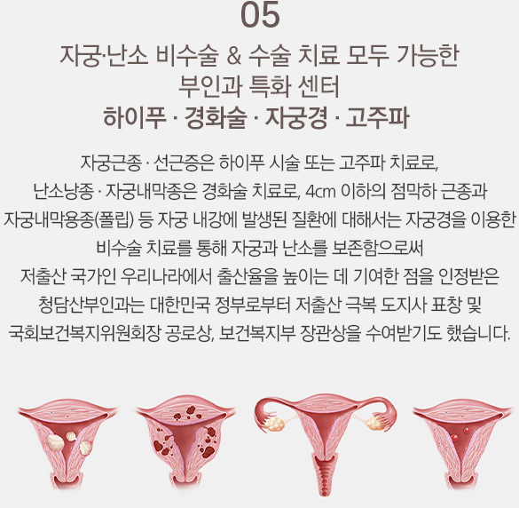 임산과 출산 최적화 2+1 진단시스템